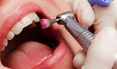 Профессиональная гигиена