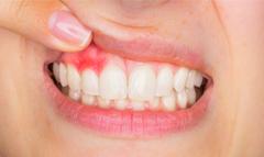 Пародонтология